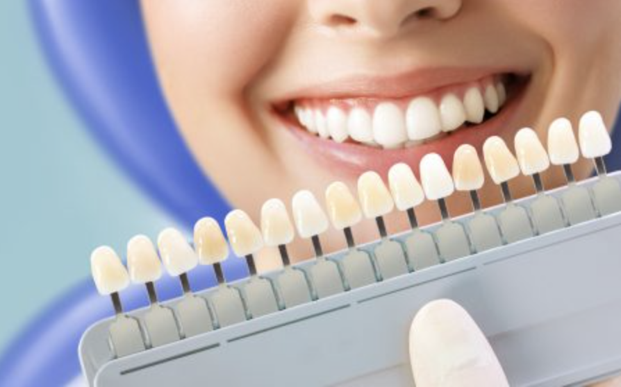 Dentist-Toa-Payoh-Teeth-Whitening